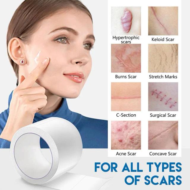Efficient Silicone Scar Removal Gel Tape For Surgery Scar Repair Sticker Sheet Therapy Patch Waterproof Skin Care Patches G5W7 on Productcaster.