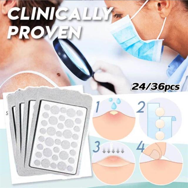 New Ance Pimple Patch Plaster Skin Tag Remover Patch Acne Cream Hydrocolloid Master Anti-infection Quick Absorb Face Care Tools on Productcaster.