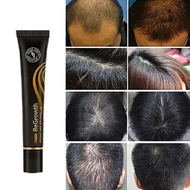 Regrowth Organic Hair Serum Roller Set Biotin Serum Triple Roll-On Massager Essence on Productcaster.