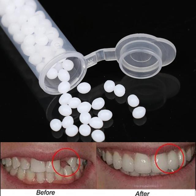 Unisex White Temporary Tooth Repair Kit Teeth And Gaps False Teeth Solid Glue Denture Adhesive Teeth Whitening Tooth Beauty Tool on Productcaster.