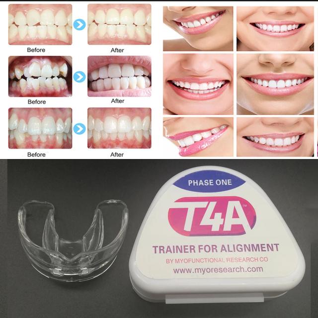 1 pcs Dental T4A Tooth Orthodontic Appliance Trainer for Alignment Braces Teeth Trainer for Adults Tooth Whitening Dentist Tools on Productcaster.