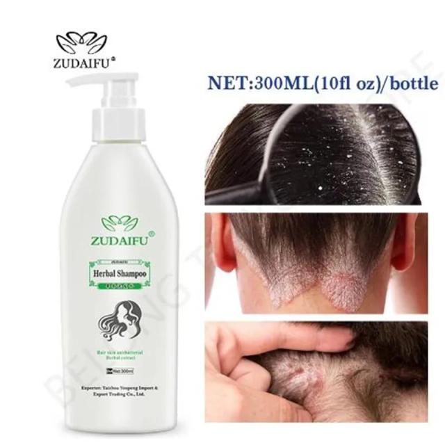 Zudaifu Hair Psoriasis Seborrheic Skin Care Treatment Dermatitis Eczema Compound Herbal Shampoo Repair Scalp, Remove Dandruff on Productcaster.