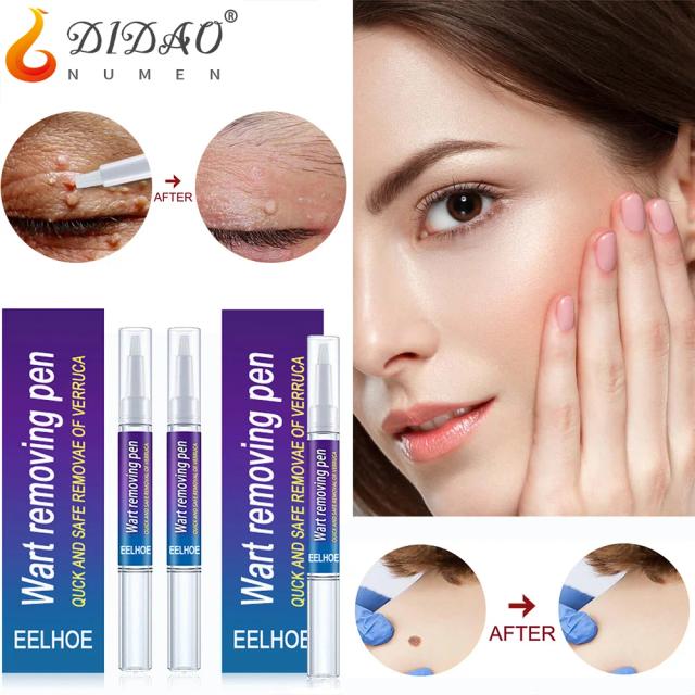 New Wart Removal Mole Liquid Pen Treatment Papillomas Removing Skin Tags Flat Genital Warts Painless Cream Anti Verruca Remedy on Productcaster.