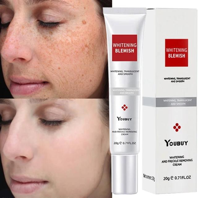 Whitening Freckle Cream Effective Remove Melasma Cream Remove Dark Spots Melanin Moisturize Brighten Smooth Face Skin Care on Productcaster.