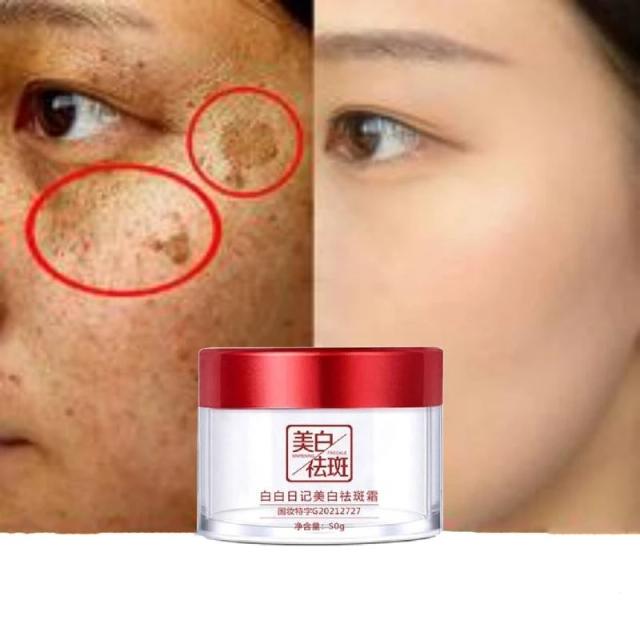 Dark Spot Corrector Skin Whitening Fade Cream Lightening Blemish Removal Serum Reduces Age Spots Freckles Face Cream 50g on Productcaster.