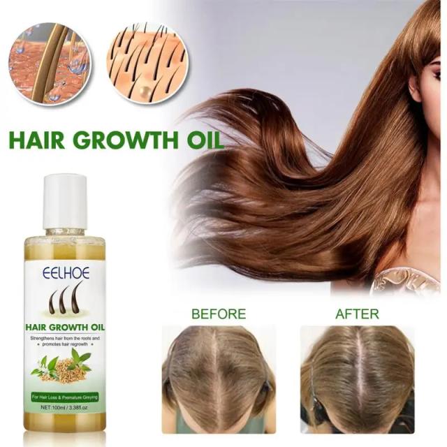 100ml Hair Growth Serum Oil Dense Moisturizes Regrowth Hair Care Oil Repair Liquid Essential Anti Loss Hair Care Essential Oil on Productcaster.