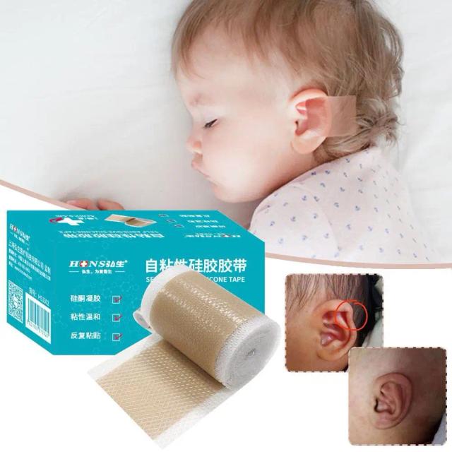 4x50cm Silicone Scars Patch Wounds Band Remove Acne Burn Scar Treatment Cover Ear Correctors Efficient Repair Damaged Skin Sheet on Productcaster.