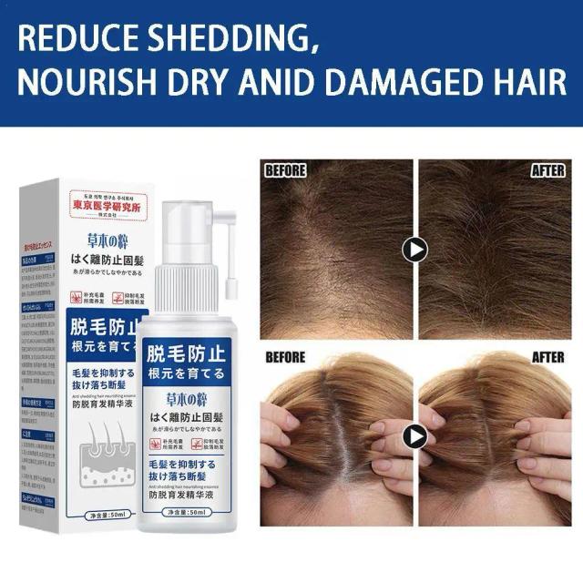 50ML Powerful Serum Spray Ginger Anti Hair Loss Treatment Care Roots Hair Fast Products Repair Regrowth Hair Nourish E0A1 on Productcaster.