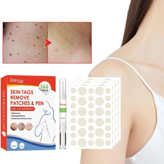 Warts Remover Plaster Skin Tags Remover Wart Treat Ment Quickly Remove Men And Women Skin Wart Formula Skin Tag Removal on Productcaster.