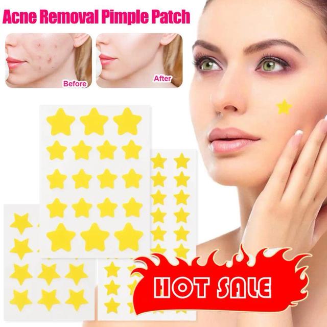 Star Pimple Patch Acne Colorful Invisible Acne Removal Skin Care Stickers Y2K Originality Concealer Face Spot Beauty Makeup Tool on Productcaster.