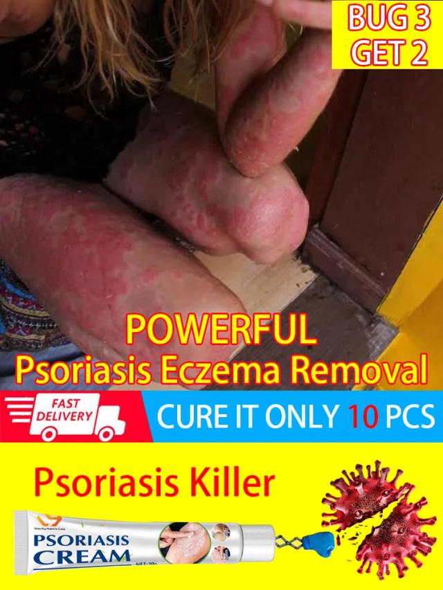 Psoriasis Cream Ointment For Psoriasis Skin Eczema Best Against Psoriasis Treatment Products on Productcaster.