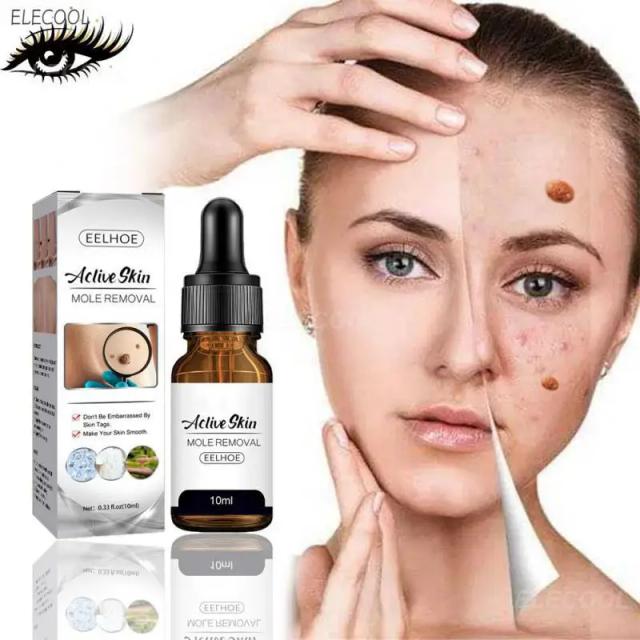 Wart Mole Removal Painless Fast Remover Serum Wart Tag Serum Skin Removal Mole Fast Remover Skin Care on Productcaster.