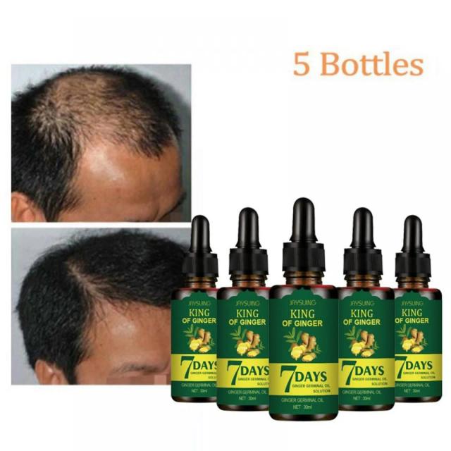 Hair Care Hair Growth Essential Oils Essence Original Authentic Hair Loss Liquid Health Care Beauty Dense Hair Growth 150ml on Productcaster.