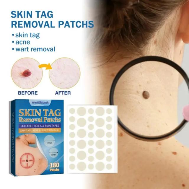 188Pcs Warts Remover Plaster Skin Tags Removal Medicine Face Moles Papiloma Sticker Genital Wart Foot Corn Beauty Health on Productcaster.