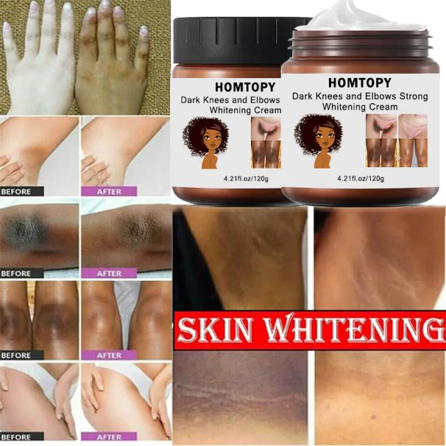 Dark Knuckles Fast Whitening Cream Pigmentation Correctors For Black Skin Hand Knuckle Elbows Knee Intense Stains Remover Cream on Productcaster.