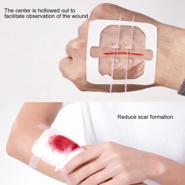 1pc Zipper Tie Wound Closure Patch Hemostatic Patch Wound Fast Suture Zipper Band-Aid Outdoor Portable on Productcaster.