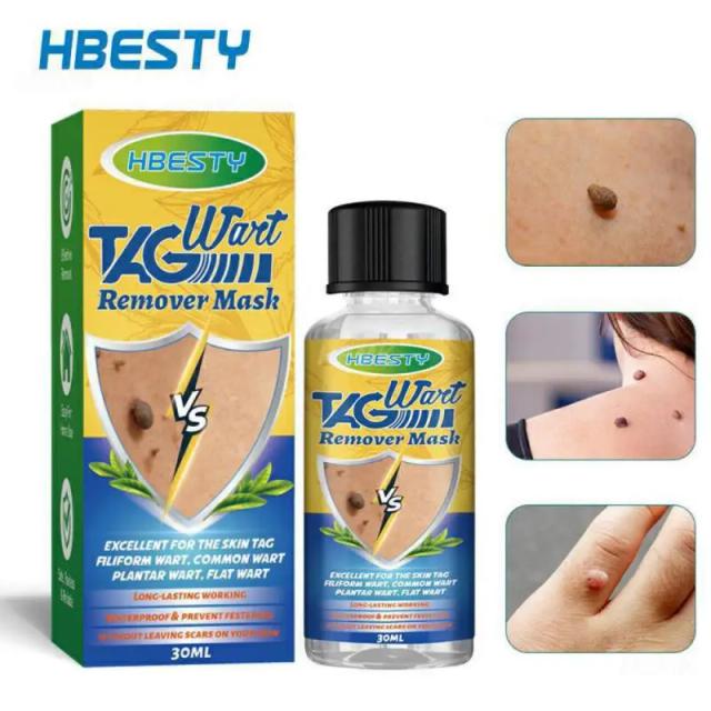 30ml Genital Wart Treatments Liquid Removal Skin Tag Mole Papillomas Foot Corn Repair Skin Herb Extract Wart Remedy Liquid Set on Productcaster.