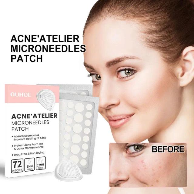 Acne Pimple Patch Stickers Acne Treatment Pimple Remover Spot Care Facial Blemish Waterproof Tool Mask 72 Skin Patches W1Q8 on Productcaster.