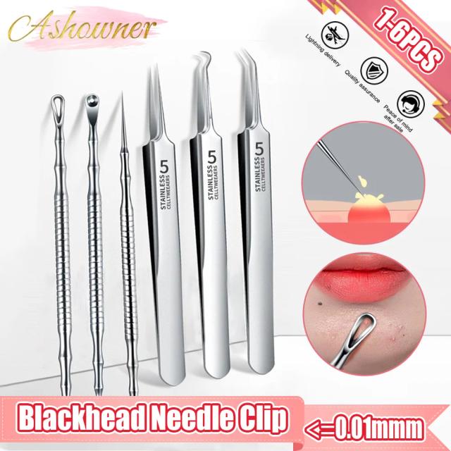 Ashowner German Ultra-fine Cell Pimples Blackhead Whitehead Clip Tweezers Remove Acne Fat Particles Beauty Needle Pore Cleaner on Productcaster.