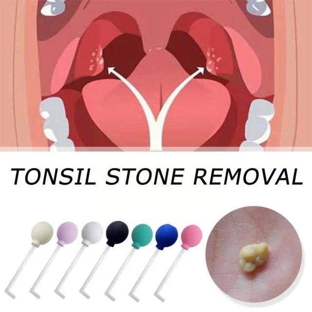 Oral Stone Remover Rectangular Long Tube Glass Cleaning Ware Tonsil Ball Cleaning Material Oral Tool Manual Stone Suction P B9D4 on Productcaster.