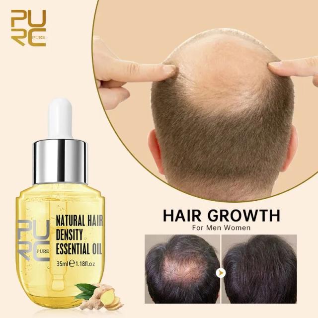 PURC Natural Hair Growth Thickener Regrowth Serum Treatments Oil Fast Grow Hair For Hair Loss Care Products Men & Women on Productcaster.