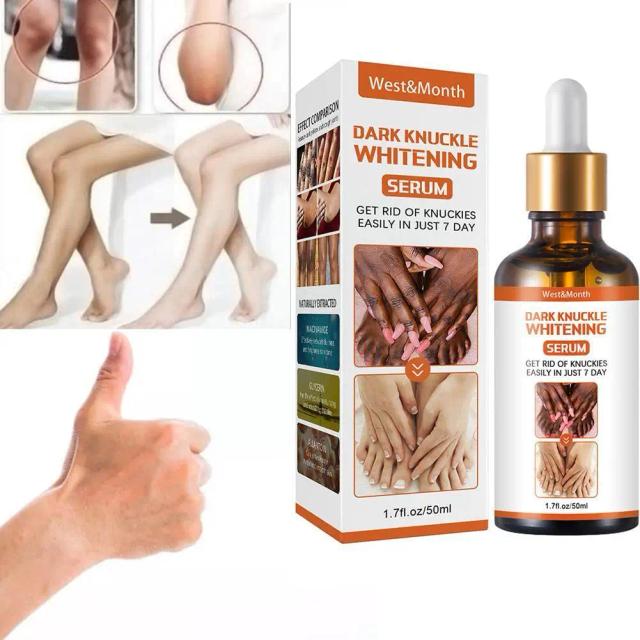 Get Rid Of Dark Knuckles In 7 Days Serum Whitening Removing Dark Knuckles Serum Hand Knuckle Eraser Serum For Elbow And Knee on Productcaster.