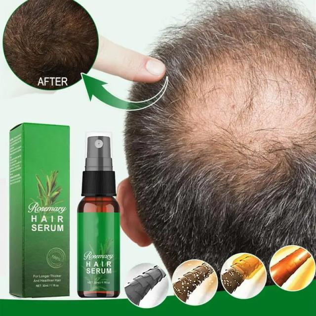 30ML Rosemary Essential Oil Hair Growth Pure Natural Oils Fast Hair Growth Essential Oils For Men And Women Seborrheic Hair Loss on Productcaster.