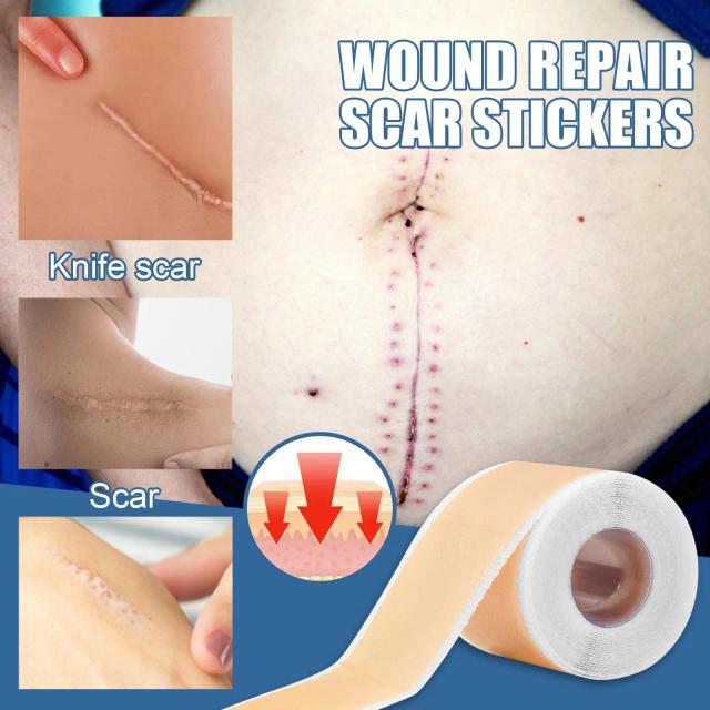 Silicone Scar Sheet Skin Repair Patch Removal Therapy Patch Burn Acne Scar Skin Care Tool Self Adhesive Stretch Mark Tape on Productcaster.