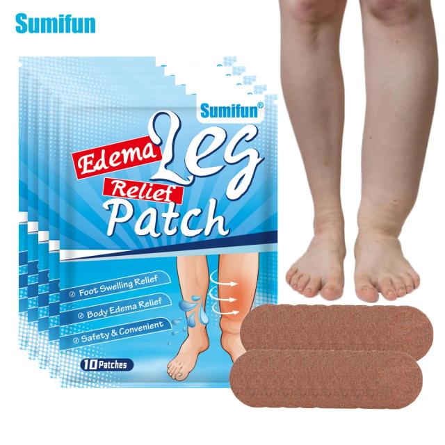 10/30/50Pcs Sumifun Edema Patches Relieve Arm Thigh Dropsy Swelling Sticker Leg Pain Relief Massage Health Care Medical Plaster on Productcaster.