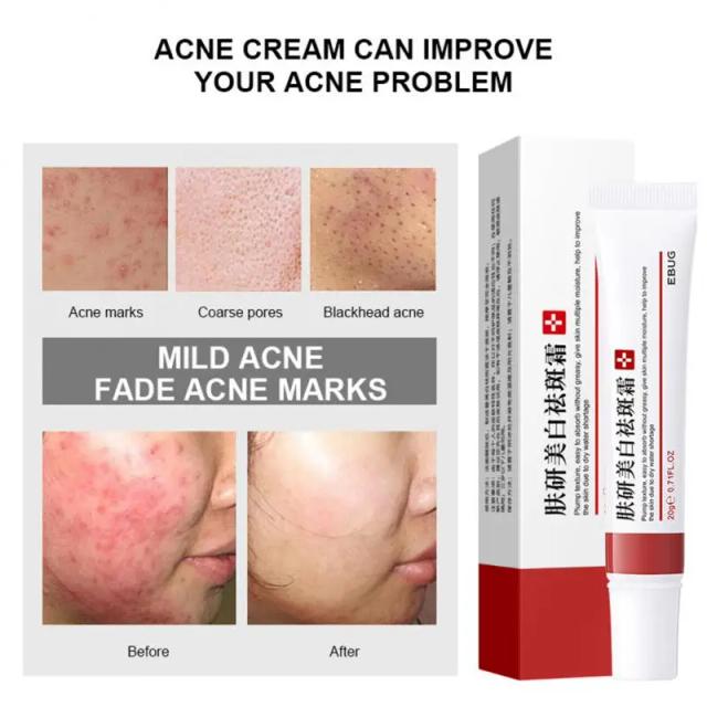 Whitening Freckle Cream Effective Remove Dark Spots Anti Freckle Cream Fade Pigmentation Melasma Brighten Cream on Productcaster.