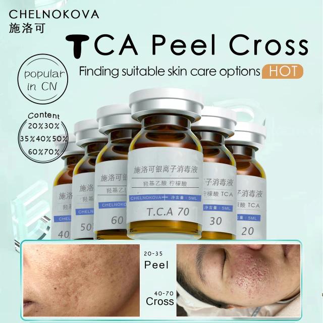 TCA 20% 30% 50% 70% tca Peel Acid Peeling Acid 7-15 Days Delivered Skin Superforce peeling Pigmentation Acne scar on Productcaster.