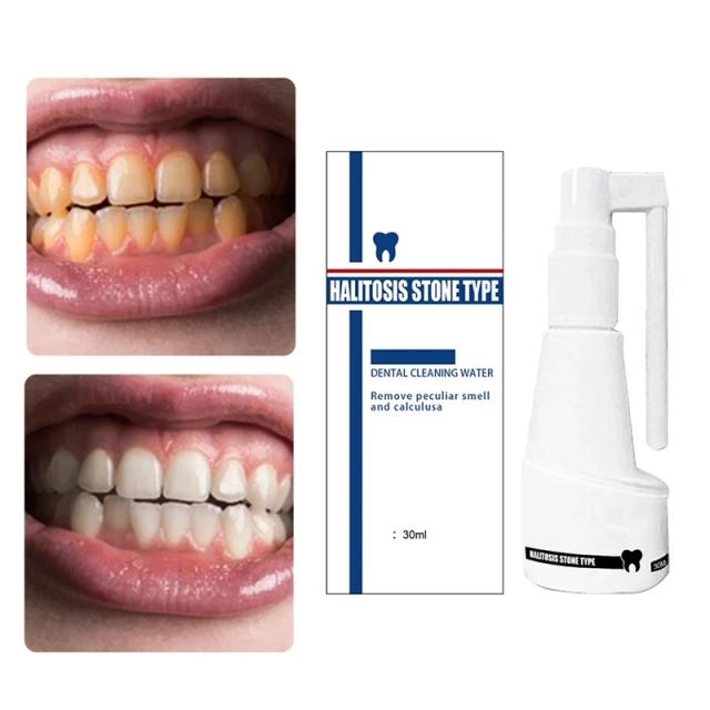 30ml Dental Calculus Cleaning Halitosis Stone Essence Remove Plaque Stains Breath Teeth Whitening Spray Peculiar Smell Oral Care on Productcaster.