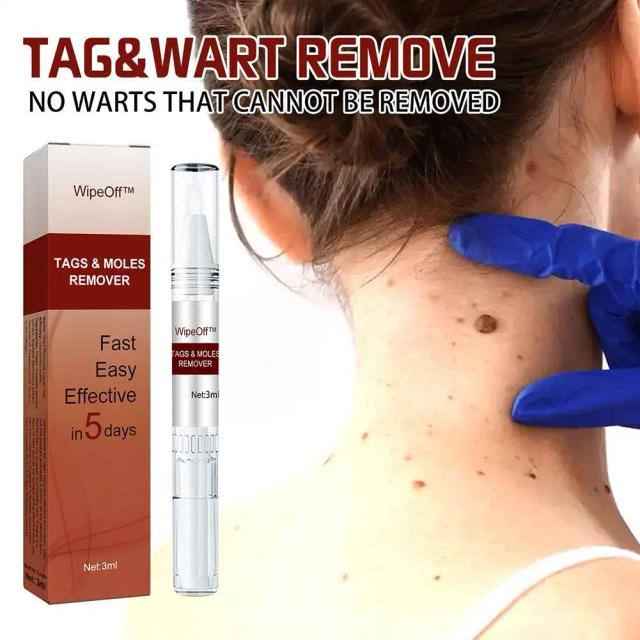 3ml Skin Tag Remover Medical Against Moles Removal Wart Acne Spot Treatment Anti Wart Skin Care Liquid Beauty Tools Women on Productcaster.