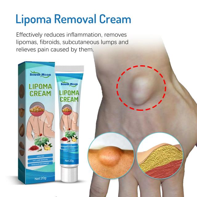 20g Lipoma Removal Cream Relief Pain Treat Skin Swelling Lipolysis Cellulite Fat Lump Nodule Removal Ointment Anti-tumor Plaster on Productcaster.