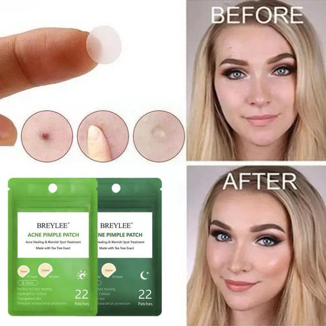 BREYLEE 0.1mm Natural Tea Tree Acne Pimple Patch Stickers And Blemish Spot Day Waterproof Skin Night Use Care Mask Facial T A6L2 on Productcaster.