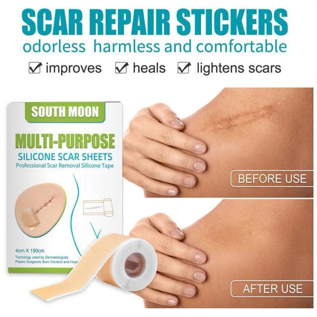 Silicone Scar Patch Wounds Scar Removal Sheet Burn Skin Repair Band Treatment Cover Efficient Repair Damaged Skin Tape 4cmx150cm on Productcaster.