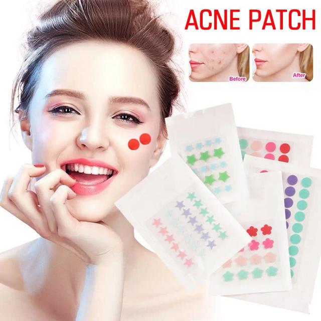 Acne Patch Waterproof Acne Pimple Treatment Stickers Freckle Care Scare Facial Skin Blackhead Spot Concealer Face Removal M X9C0 on Productcaster.