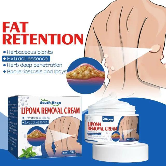 New Skin Care Tumor Removal Exfoliating Lipoma Treat Lipoma Removal Cream Delipidation Cream Skin Swelling on Productcaster.