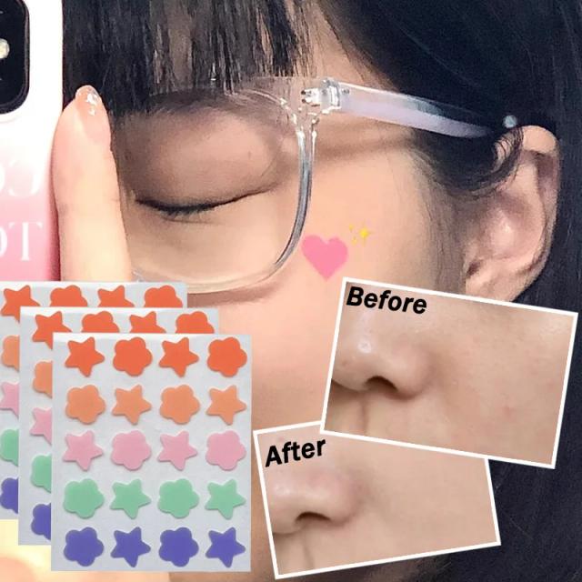 Cute Heart Flower Invisible Acne Removal Pimple Patch Beauty Acne Tool Pimple Acne Concealer Face Spot Scar Care on Productcaster.