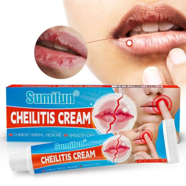 20g Cheilitis Treatments Cream Inflammation Labial Herpes Antibacterial Ointment Chapped Lips Wrinkles Rehydration Lipstick on Productcaster.