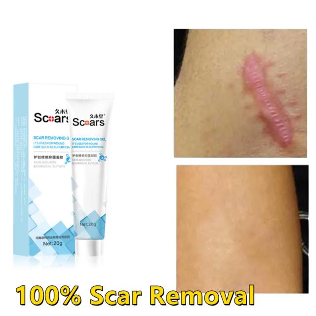 Wound Scar Removal Cream Gel Scar Desalinization And Removing Ling Scar Keba Scar Removal Herbal Scar Repair Cream 20g on Productcaster.