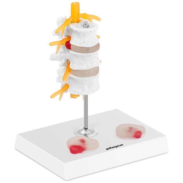 Porckorong modell - porckorongsérv - színes | physa on Productcaster.