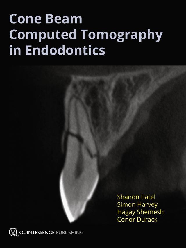 Cone Beam Computed Tomography in Endodontics on Productcaster.