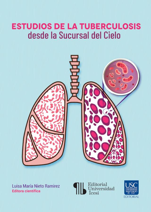 Estudios de la tuberculosis desde la Sucursal del Cielo on Productcaster.