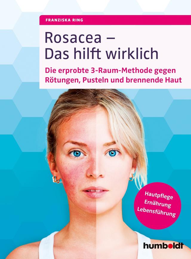 Rosacea – Das hilft wirklich on Productcaster.