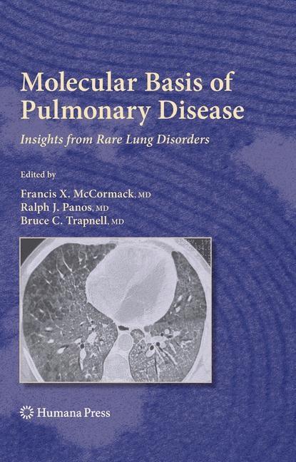 Molecular Basis of Pulmonary Disease on Productcaster.