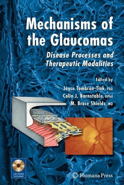 Mechanisms of the Glaucomas on Productcaster.