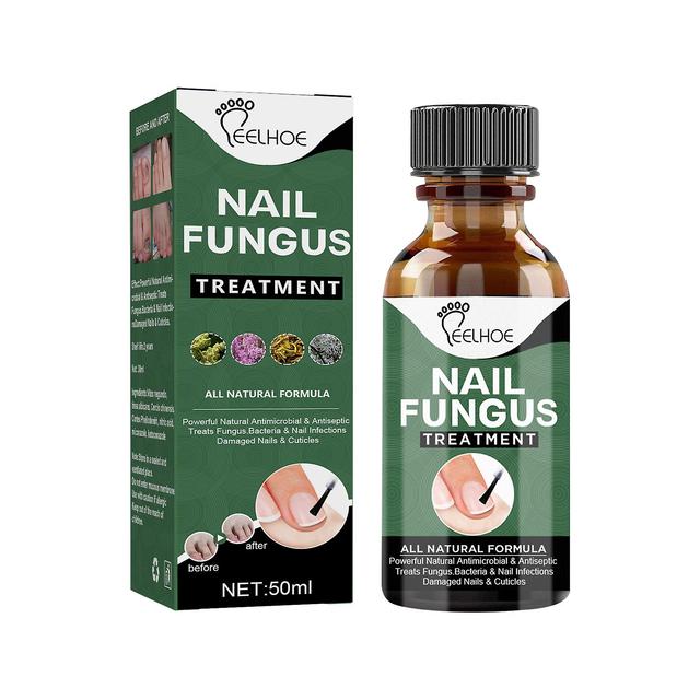 50ml Solution de traitement des champignons des ongles Extraits de plantes Supprimer on Productcaster.