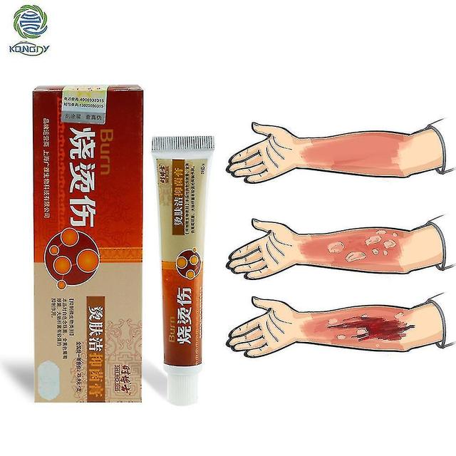 christina show Burn Ointment 40gx2 Repair Scar Skin Burn Skin Treatment Cream 100% Chinese Traditional Plant Herbs on Productcaster.