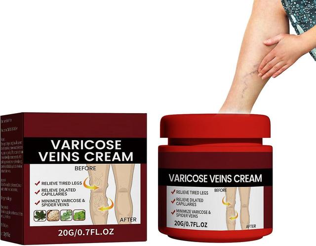 Medilisk Cream Varicose Veins for Legs, Strengthen Health&Improve Blood Circulation 1 pcs on Productcaster.